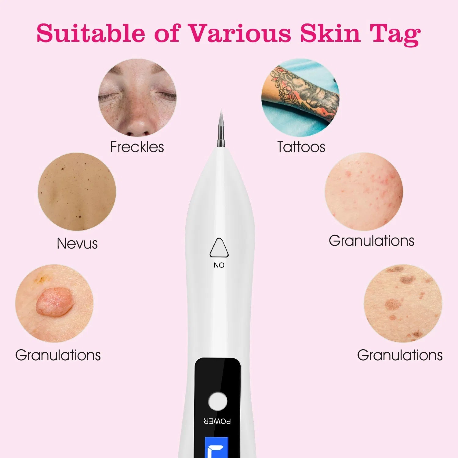 Professional Skin Tag Remover LCD Adjustable Precision Repair Kit