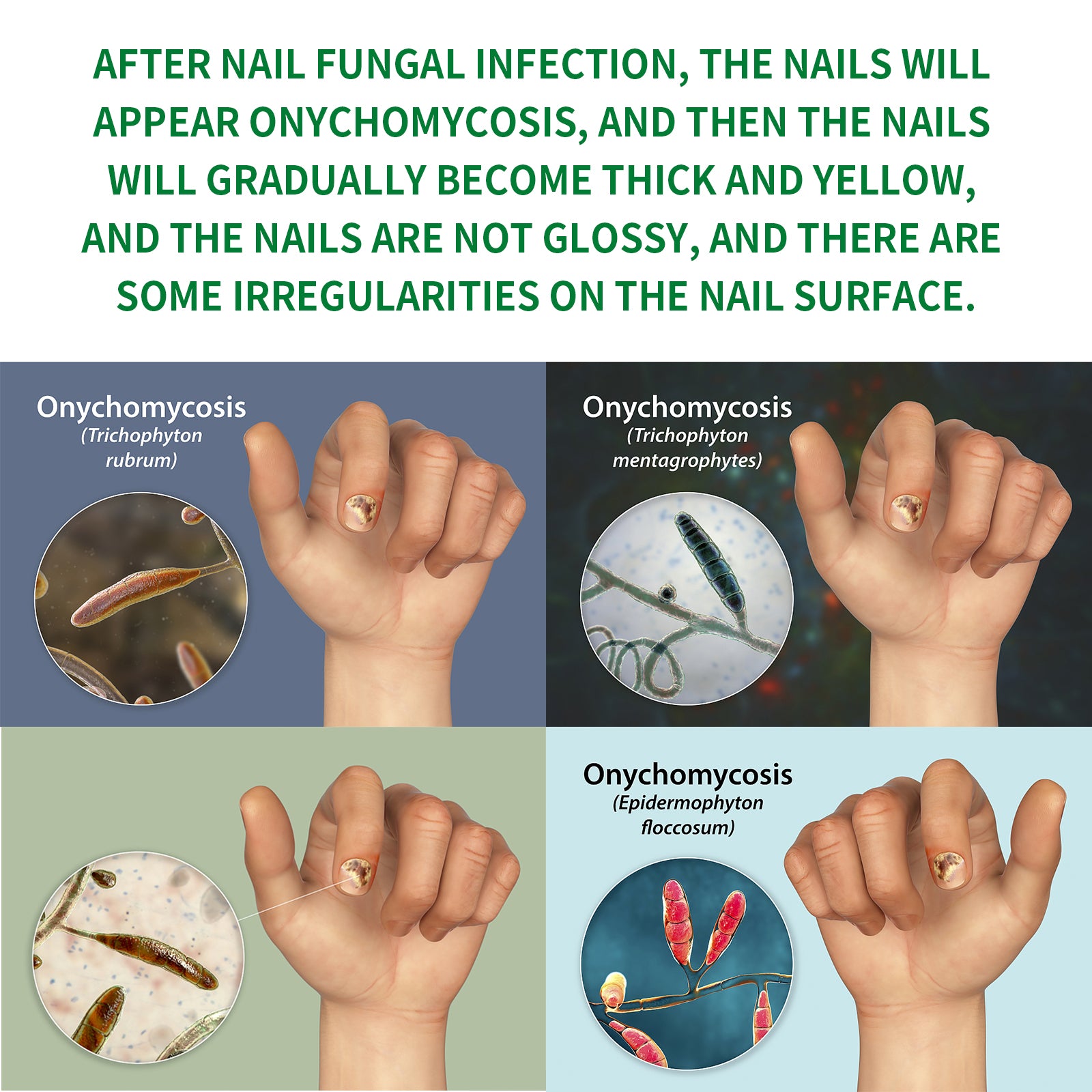 Jaysuing Ginger Nail Care Liquid for Smooth Nails