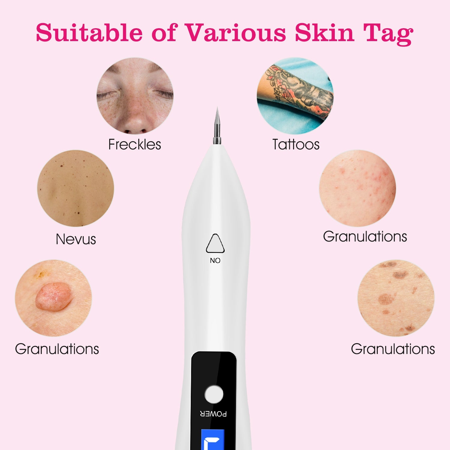Advanced Skin Tag Remover Kit 9 Level Precision Spot Treatment