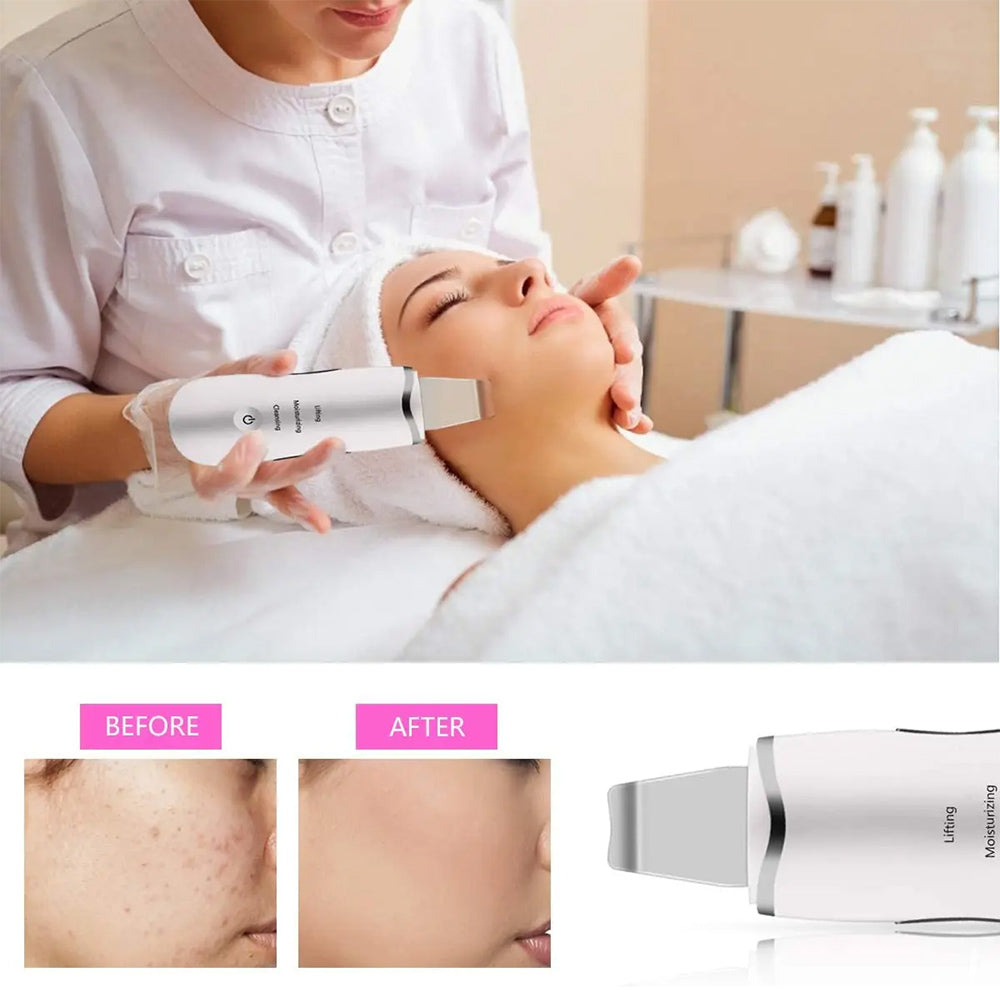 3-in-1 Ultrasonic Facial Spatula Deep Cleansing Skin Scrubber Tool