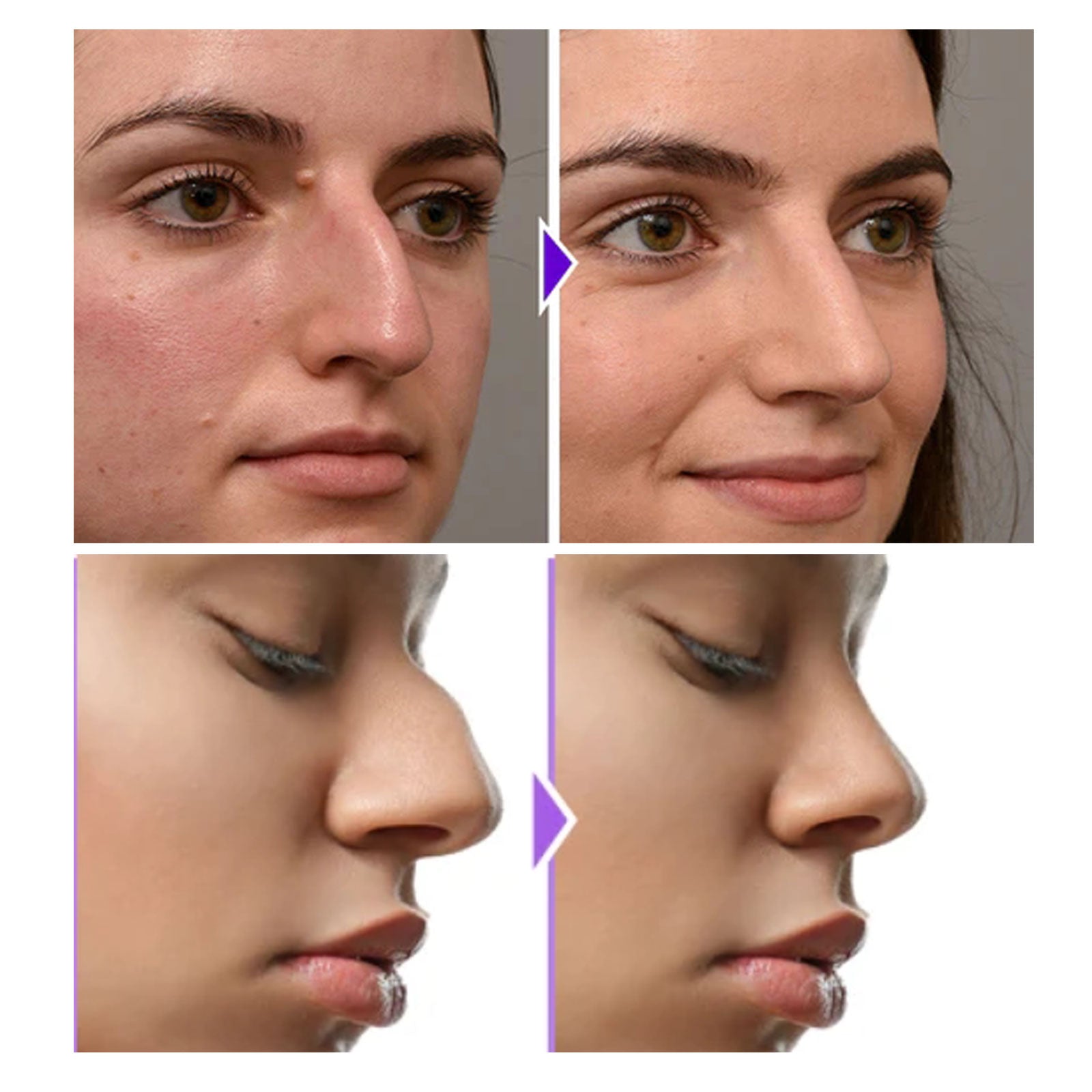 Silicone Nose Shaper Clip with EMS Beauty Massage Support