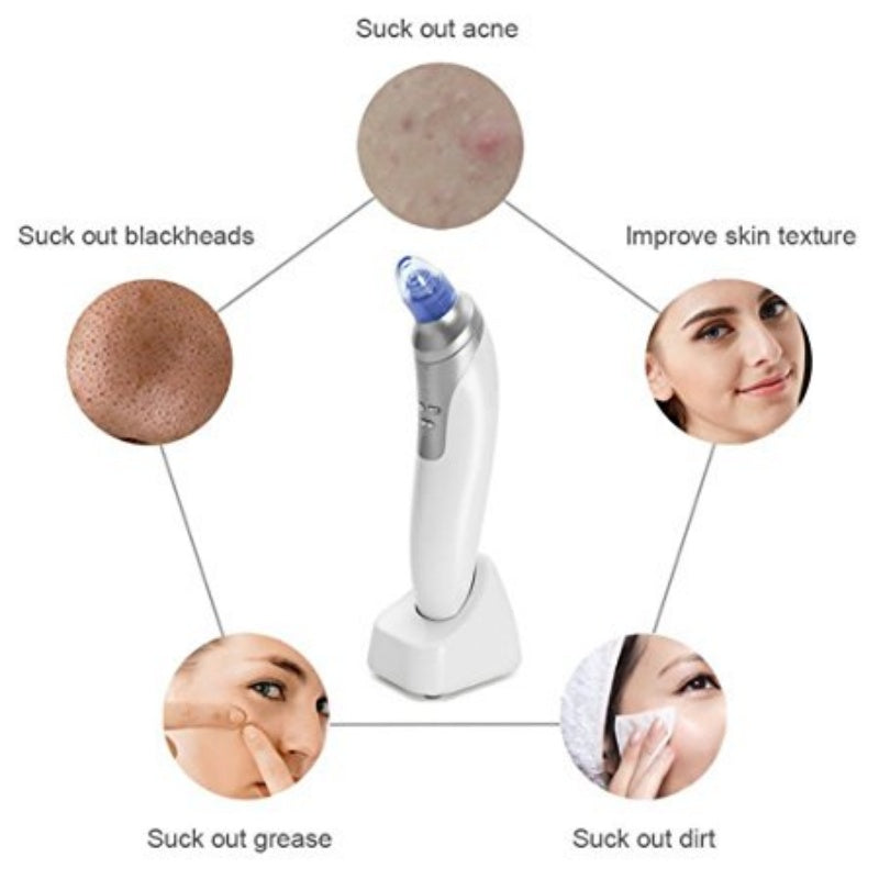 Blackhead Remover Device for Deep Pore Cleaning